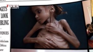 تصویر دردناک کودکی که شاید جهانیان را یاد یمن بیاندازد!