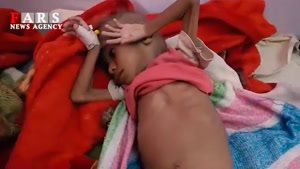 وضعیت دردناک کودکان یمنی