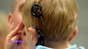 حرکت حلزونی واردات حلزون شنوایی