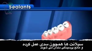 چگونه از پوسیدگی دندان کودکان جلوگیری کنیم