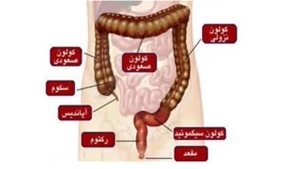 مشکلاتی که با پوشیدن لباس های تنگ بوجود می آید