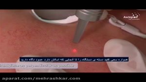 درمان ضایعات پوستی با لیزر