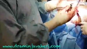 جراحی تعویض کامل مفصل ران توسط دکتر جواهری