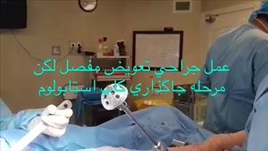 عمل جراحی تعویض مفصل لگن / مرحله ی جایگذاری کاپ استابولوم