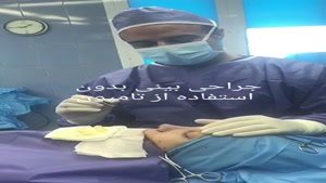 جراحی بینی بدون تامپون