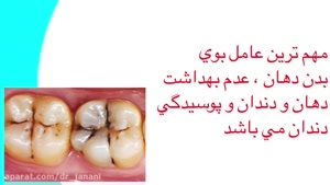 علت بوی بد دهان