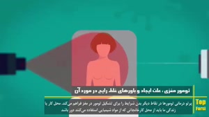 آیا میدانید که تومور مغزی به چه دلایلی ایجاد میشود و یا اینکه باورهای غلط درباره آن چیست؟