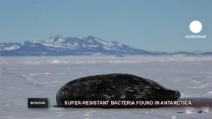 باکتری های فوق مقاوم به آنتی بیوتیک