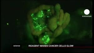 یک پیشرفت در تشخیص سلول های سرطانی