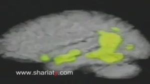 ساختار مغز انسان