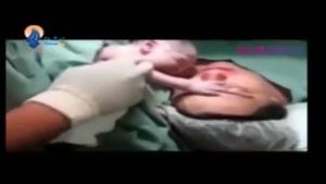 اولین برخورد جالب مادر و فرزند بعد از بدنیا آمدن.