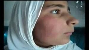 نشانه های عجیب روی بدن دختر مسلمان