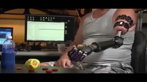 بازوی مصنوعی رباتیک کنترل شونده با ذهن برای معلولان