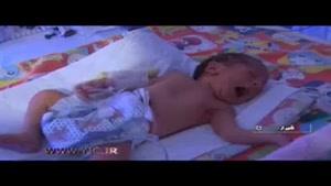 تولد سی هزار نوزاد معلول به خاطر اختلالات ژنتیکی
