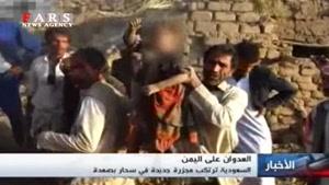  صحنه دلخراش بیرون آوردن کودک یمنی از زیر آوار