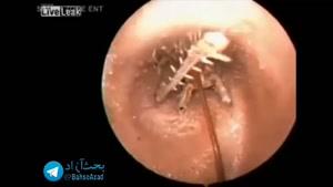 این آقا به خاطر گوش درد به پزشک مراجعه می کنه، ببینید علت گوش دردش چی بوده! 😰