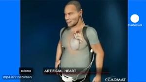 قلب مصنوعی با عمر پنج سال در بدن انسان