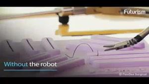 فیلم/ ابزار جراحی ارزان با دقت روبات