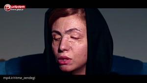 اسیدپاشی وحشیانه روی عروس ایرانی؛ چشم هایی که پای کینه پدرشوهر سنگ دل کور شدند/اختصاصی تی وی پلاس