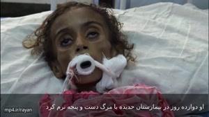 سرگذشت غم انگیز جمیله؛ دختری یمنی که از گرسنگی جان سپرد