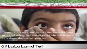پزشک ایرانی که چشم مصنوعی با قابلیت دید اختراع کرده
