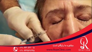 تزریق بوتاکس | فیلم تزریق بوتاکس | کلینیک پوست و مو رز |9
