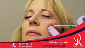 تزریق بوتاکس | فیلم تزریق بوتاکس | کلینیک پوست و مو رز |11