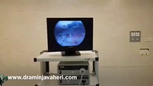 جراحی آرتروسکوپی رباط صلیبی قدامی توسط دکتر علیرضا امین جواهری