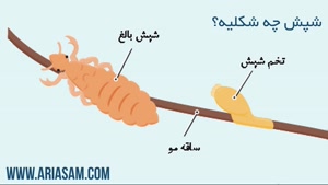 شامپو شپش موی دی فنوترین محصولی قوی  و خارجی 100% تضمینی