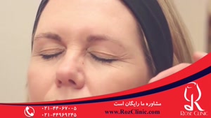 تزریق بوتاکس | فیلم تزریق بوتاکس | کلینیک پوست و مو رز |12