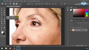 حذف جوش‌ و لکه های پوستی از تصاویر با برنامه فتوشاپ 