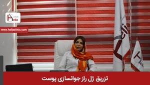 تزریق ژل راز جوانسازی پوست | کلینیک هلیا | 02122819418 برداشتن خال