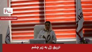 تزریق ژل به زیر چشم برای زیبایی | کلینیک هلیا | ۰۲۱۲۲۸۱۹۴۱۸