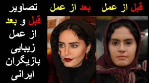 بازیگران زن ایرانی قبل و بعد از عمل زیبایی