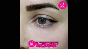  تزریق ژل | فیلم تزریق ژل | کلینیک پوست و مو رز | شماره 66