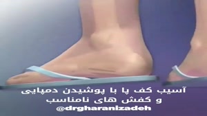 آسیب کف پا با پوشیدن دمپایی