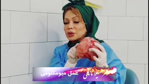 فیلم عمل جراحی میومکتومی توسط دکتر سهیلا نانکلی