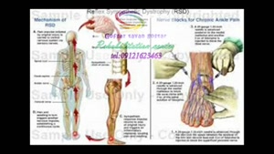 برترین مرکز توانبخشی در البرز 09121623463|هفت تیر خیابان امام زاده حسن 