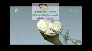 تخصصی ترین مرکز کاردرمانی جسمی در البرز 09121623463|خیابان قلم خیابان۱۶ متری