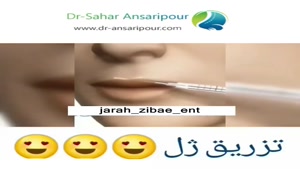 انیمیشن نحوه تزریق ژل