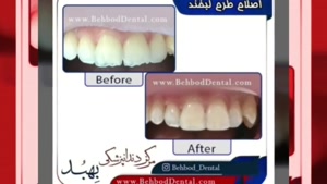 نمونه کار زیبایی و درمانی دندانپزشکی بهبد