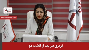 قرمزی سر بعد از کاشت مو | کلینیک هلیا | 02122810089