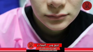 تزریق چربی | فیلم تزریق چربی | کلینیک پوست و مو رز | شماره23