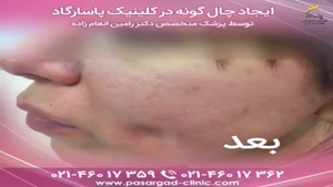 کلینیک زیبایی چال گونه ارتودنسی