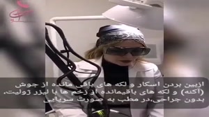 روشن کردن ناحیه باسن
