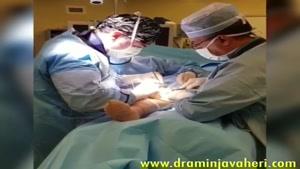 جراحی استئوتومی زانوی پرانتزی