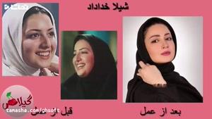 تماشا - تصاویر قبل و بعد از عمل زیبایی بازیگران ایرانی