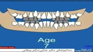 مراحل رشد و تکامل دندان انسان