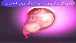 نحوه زایمان طبیعی