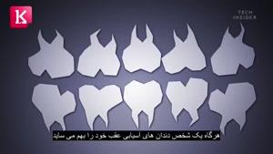 نماشا - اتفاقاتی که در زمان ساییدن بیش از حد دندان رخ می دهد
